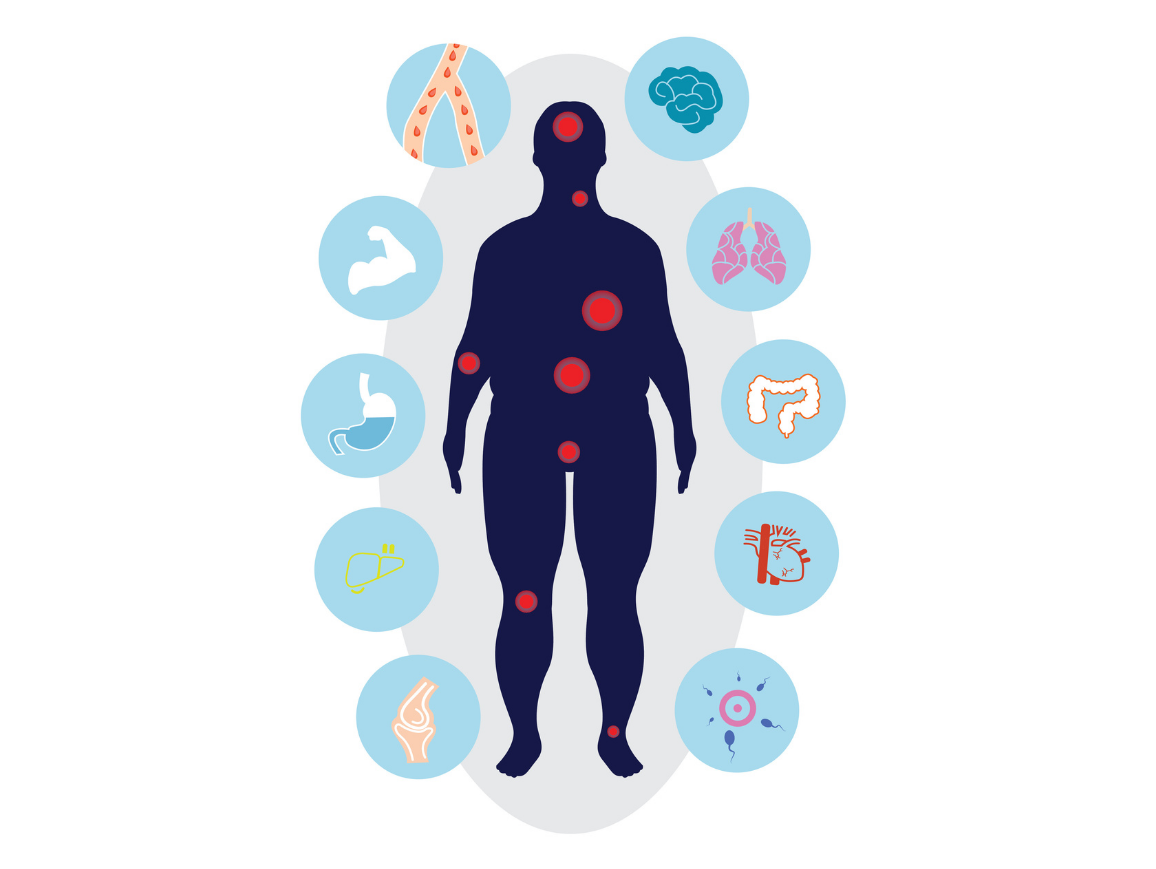 Recognize Obesity as a Disease in Need of Treatment 